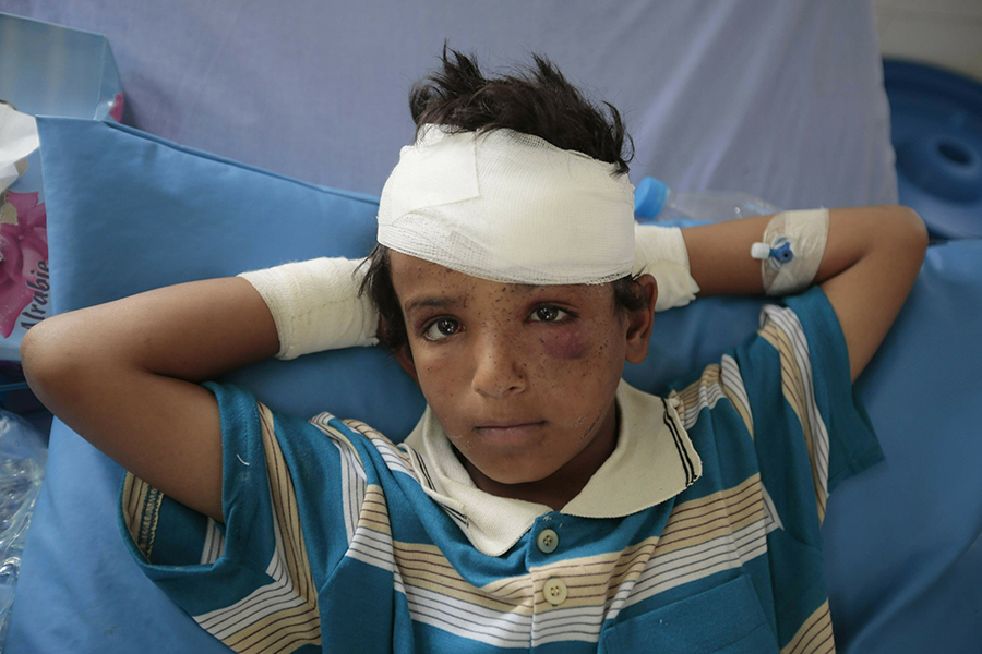 Yemen: la tragedia dei bambini.