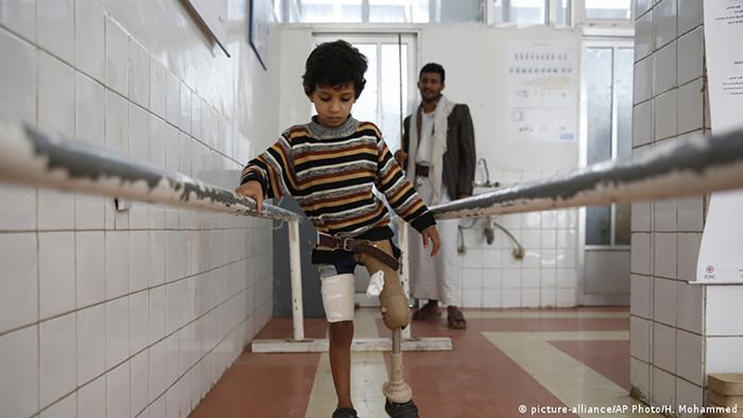 Yemen: la tragedia dei bambini.