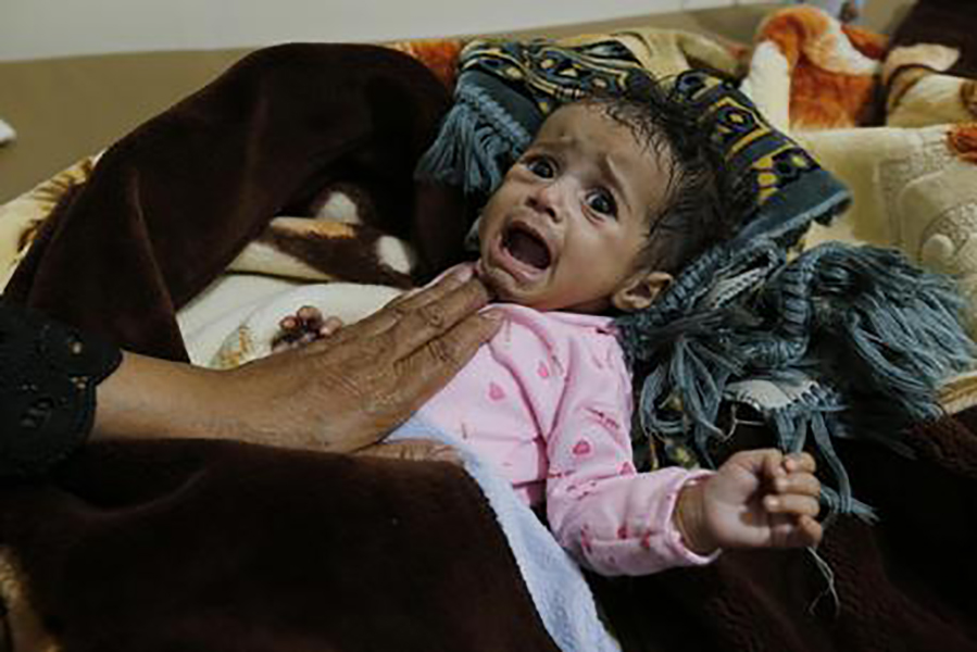 Yemen: la tragedia dei bambini.