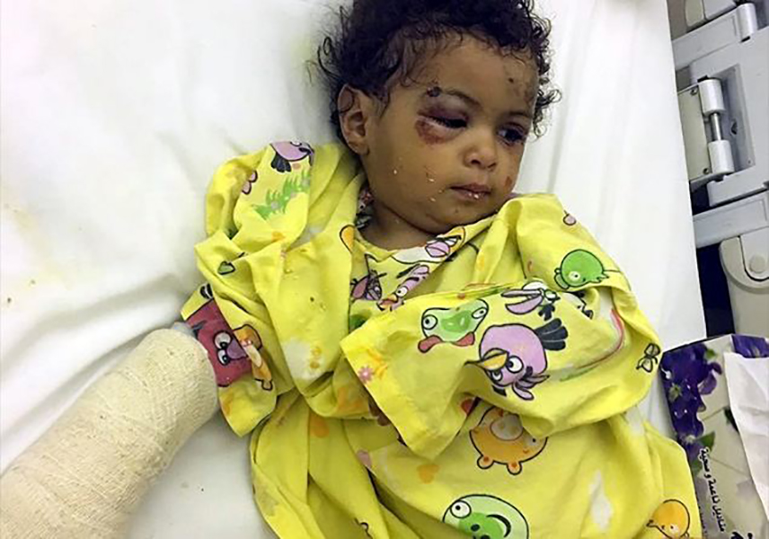 Yemen: la tragedia dei bambini.