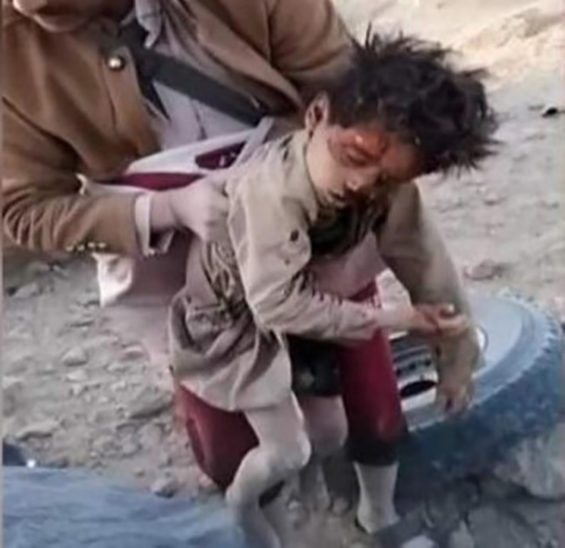 Yemen: la tragedia dei bambini.