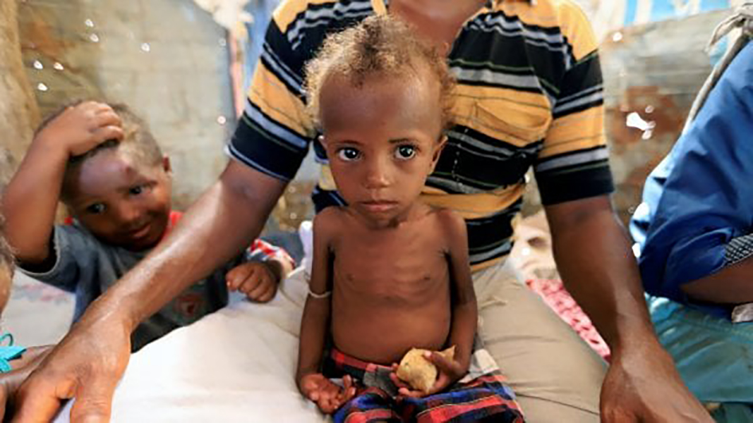Yemen: la tragedia dei bambini.