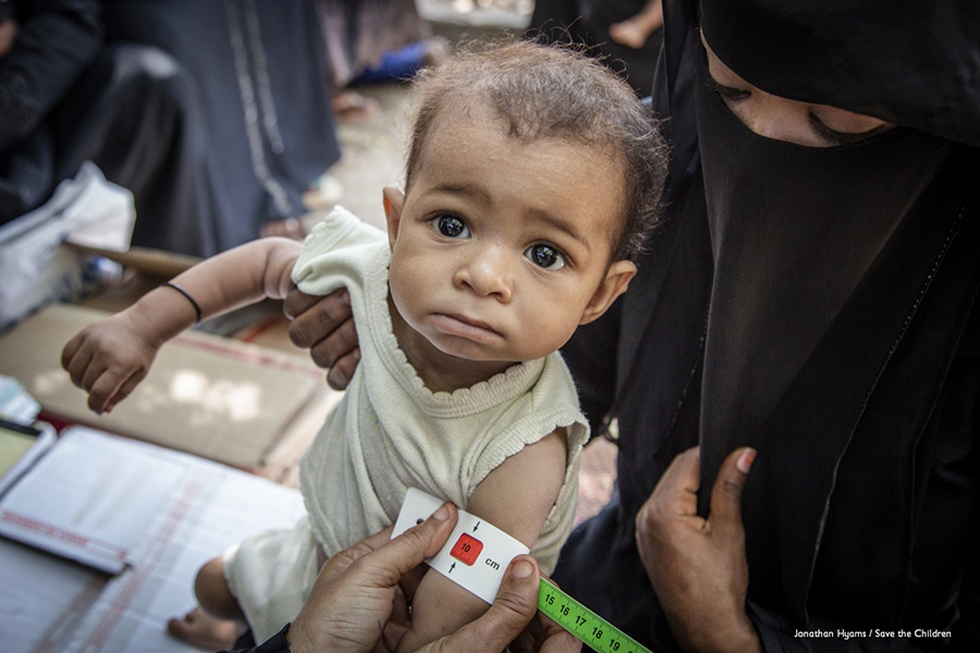 Yemen: la tragedia dei bambini.