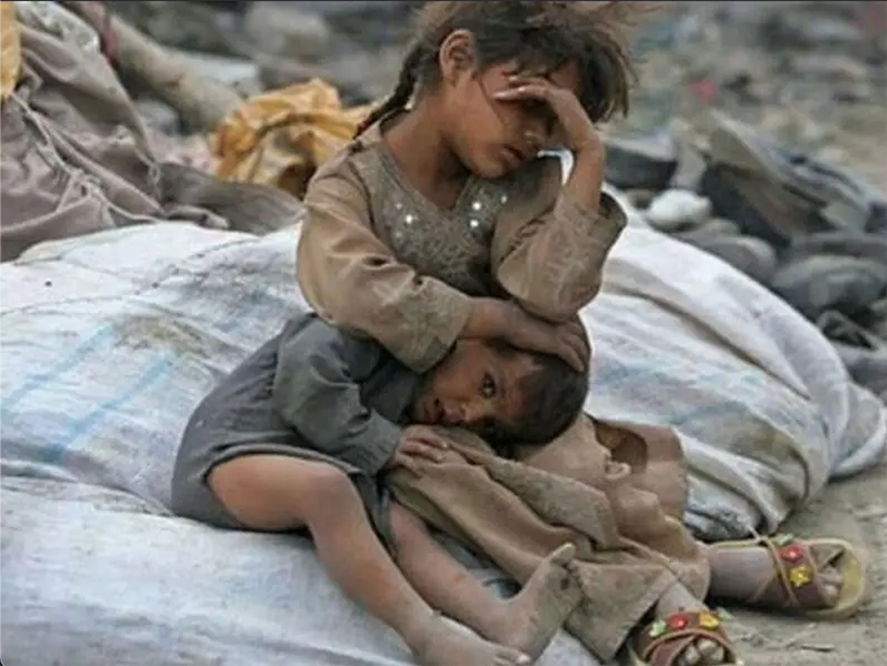 Yemen: la tragedia dei bambini.