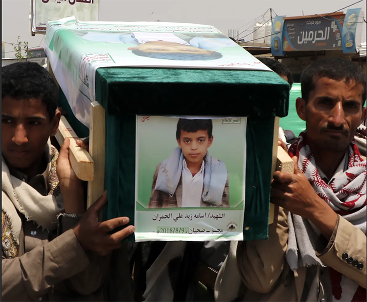 Yemen: la tragedia dei bambini.