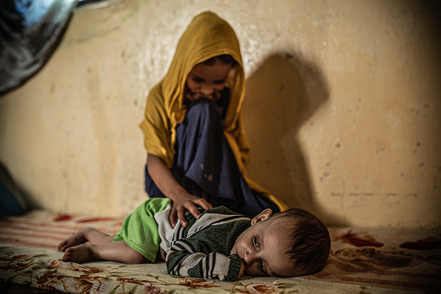 Yemen: la tragedia dei bambini.