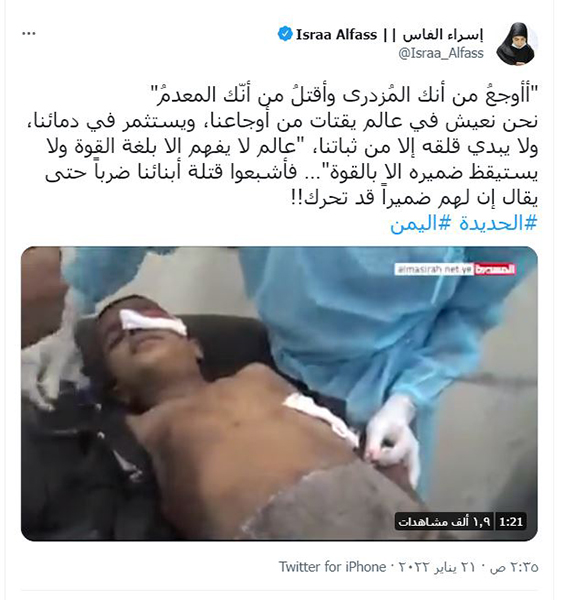 Yemen: la tragedia dei bambini.